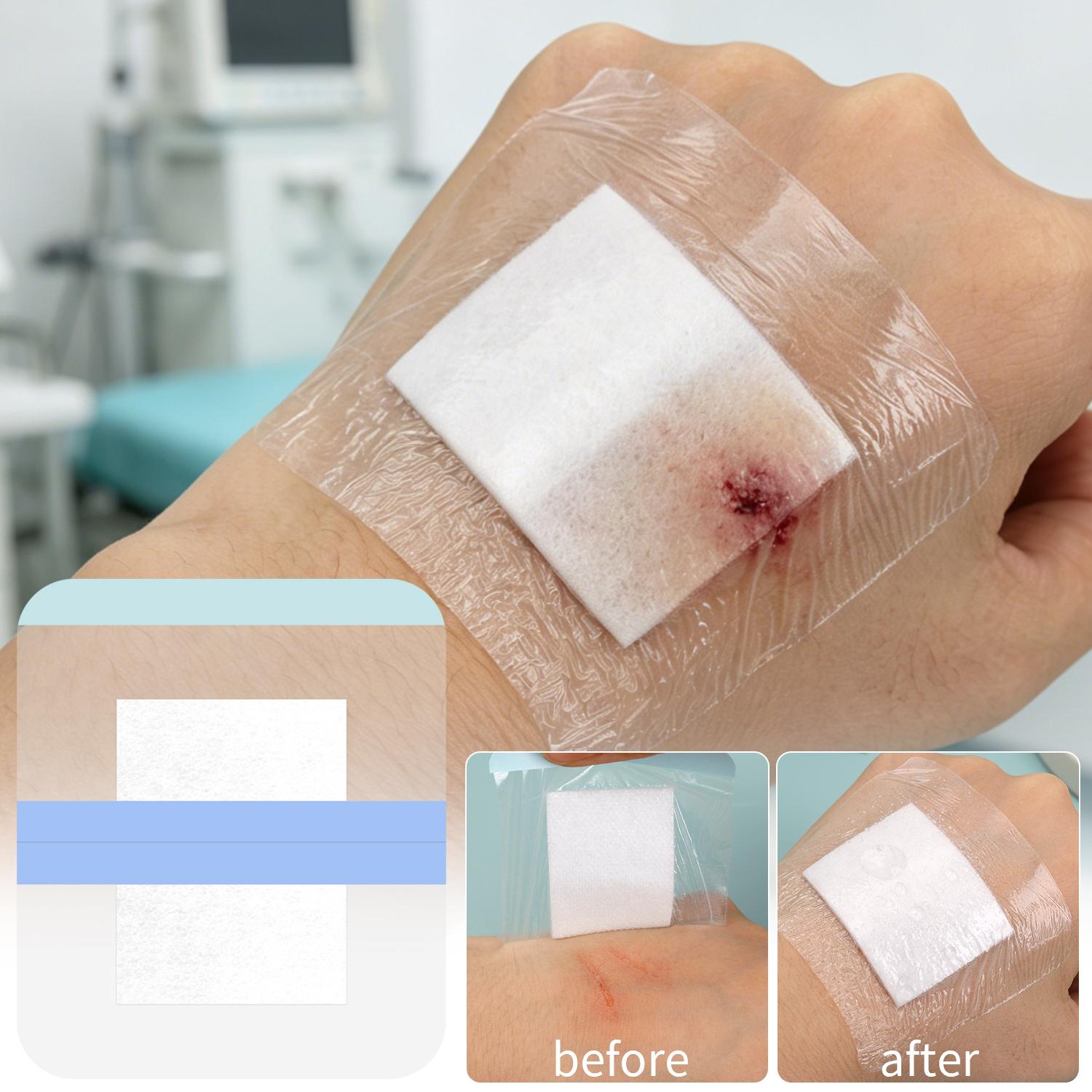 1/50Sheet Clear PU Wound Dress - Outdoor Adventure And Sports บทวิจารณ์และราคา
